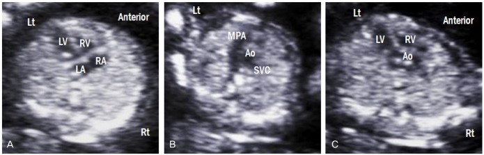 Fig. 13