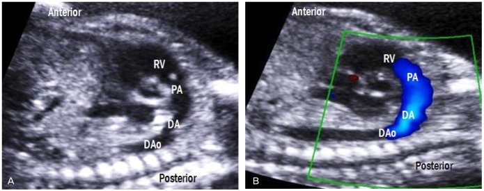 Fig. 11