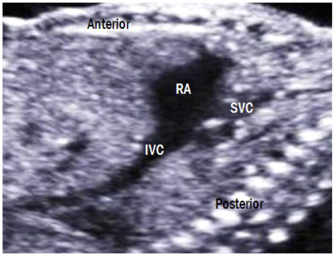 Fig. 12