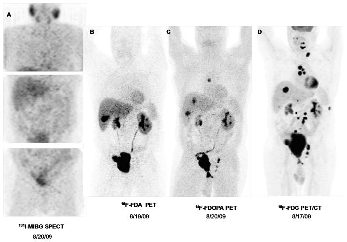 FIGURE 1