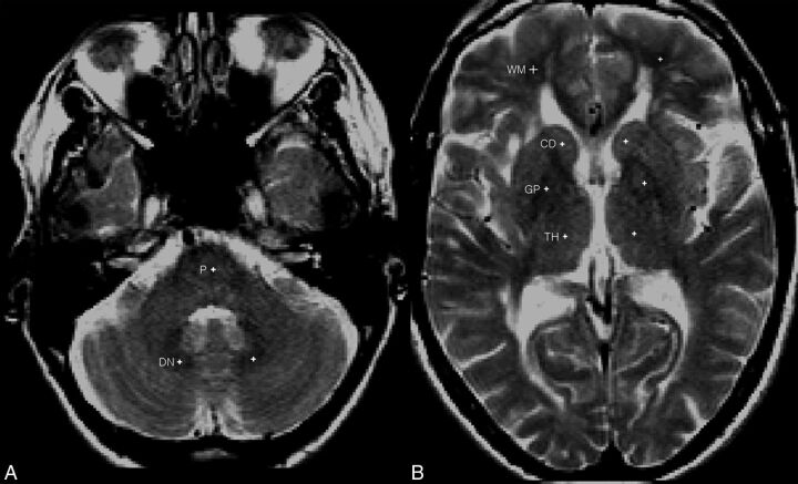 Fig 2.