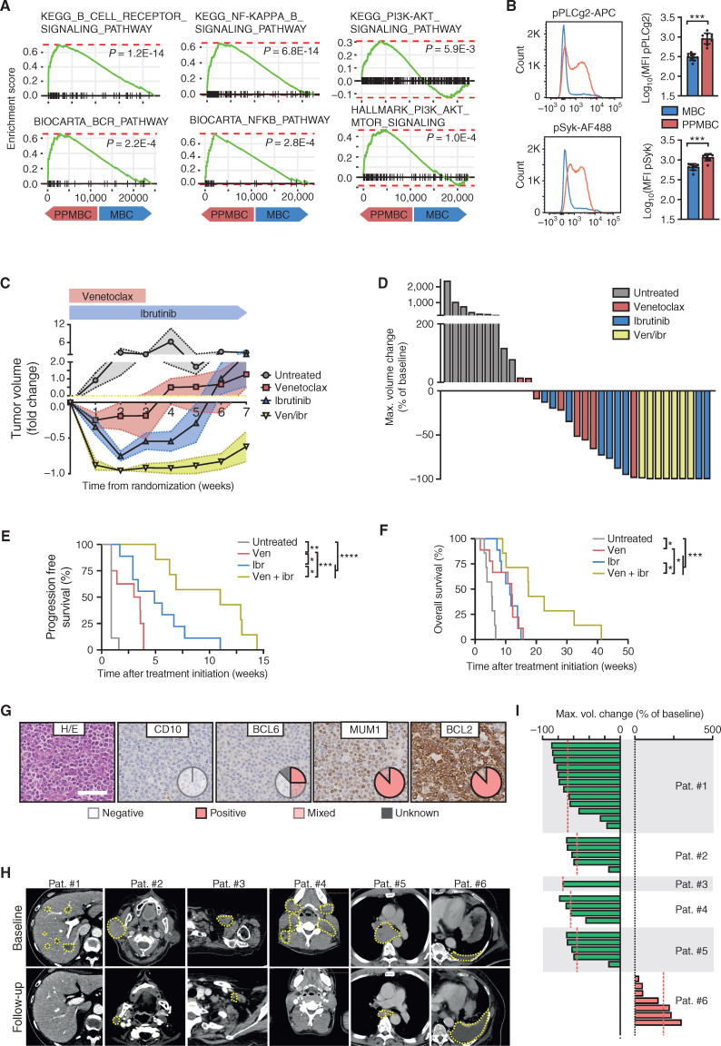 Figure 5. Murine PPMBC lymphomas and human non-GCB lymphomas are sensitive to combined treatment with venetoclax and ibrutinib. A, Gene set enrichment analysis plots for BCR-related gene signatures from the KEGG, Biocarta, and Hallmark collections, comparing PPMBC and MBC lymphomas (n = 13 each). B, Flow-cytometric analysis of phospho-PLCg2 and phospho-Syk levels in IgDneg cells from MBC (n = 10) and PPMBC (n = 10) lymphomas. C, Normalized tumor volumes after tumor detection of untreated (n = 7), venetoclax-treated (n = 8), ibrutinib-treated (n = 9), or combination-treated (n = 7) PPMBC animals. D, Best tumor volume change of untreated, venetoclax-treated, ibrutinib-treated and combination-treated PPMBC animals. E, PFS and (F) overall survival of untreated, venetoclax-treated, ibrutinib-treated and combination-treated PPMBC animals. G, Six patients were stratified as non–GCB-DLBCL by the Hans algorithm. One representative case is visualized; pie charts illustrate the distribution of staining patterns across the cohort (n = 6). Scale bar represents 50 μm. H, CT-images of patients #1 to #6. Target lesions are outlined. I, Best tumor volume change of individual target lesions of each patient. *, P ≤ 0.05; **, P ≤ 0.01; ***, P ≤ 0.001; ****, P ≤ 0.0001; B, Welch unpaired two-tailed t test; E, F, log-rank test; error bars represent SD.