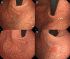 Fig. 4