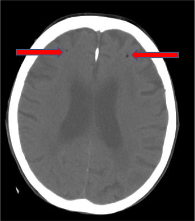 Fig. 2