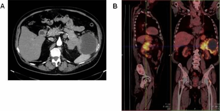 Fig. 1