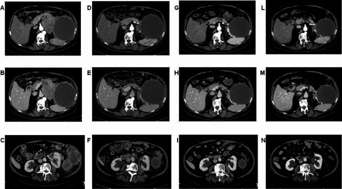 Fig. 3