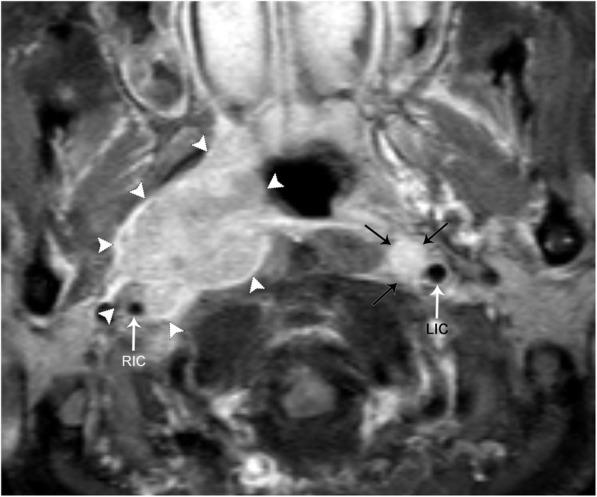 Fig. 22