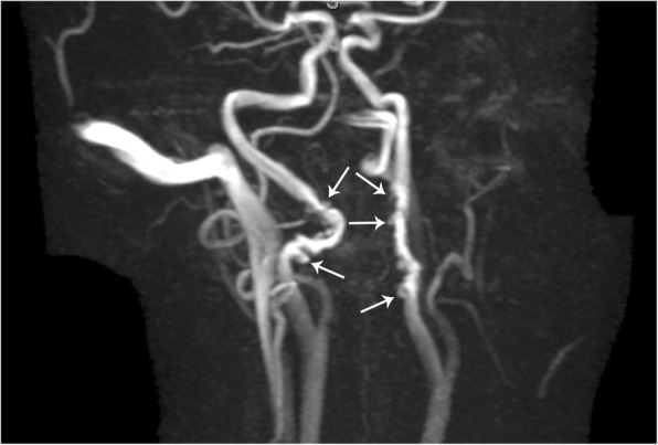 Fig. 16