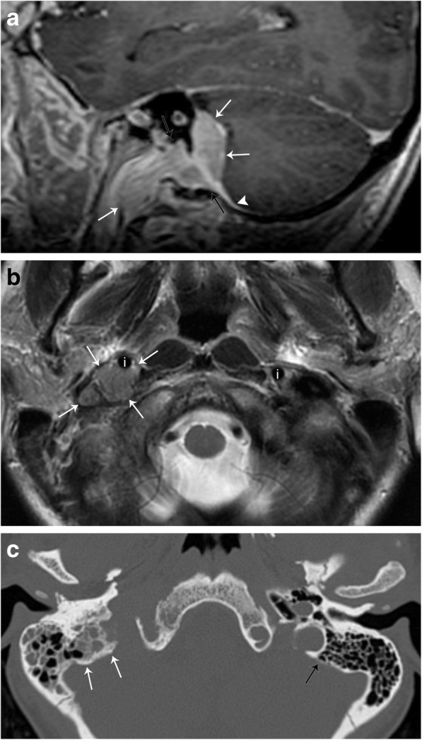 Fig. 10