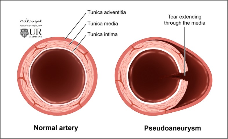 Fig. 13