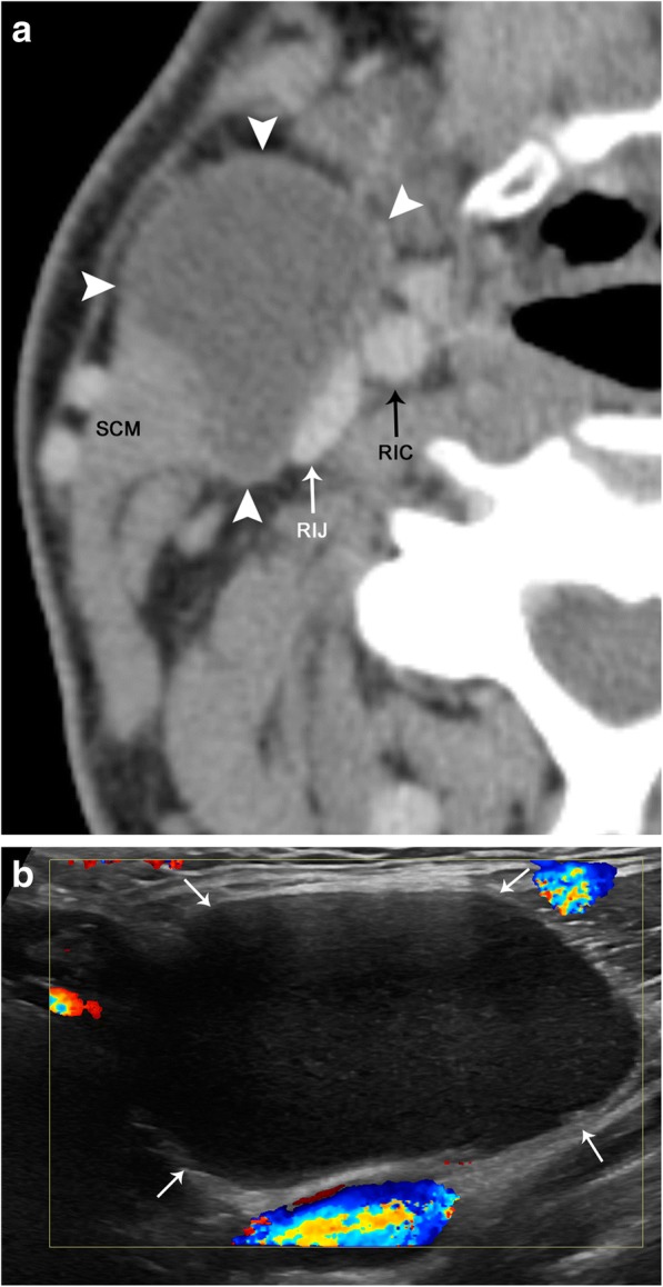 Fig. 23