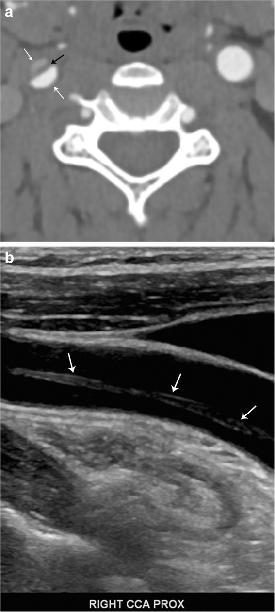 Fig. 12