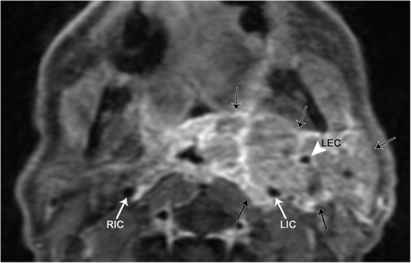 Fig. 20