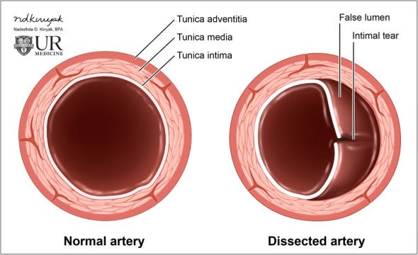 Fig. 11