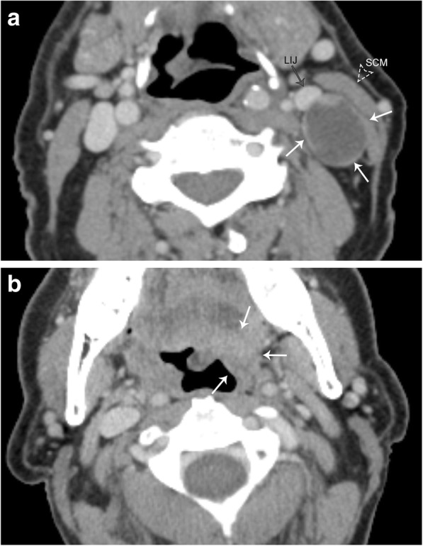 Fig. 21