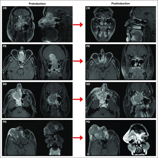 FIG 2.