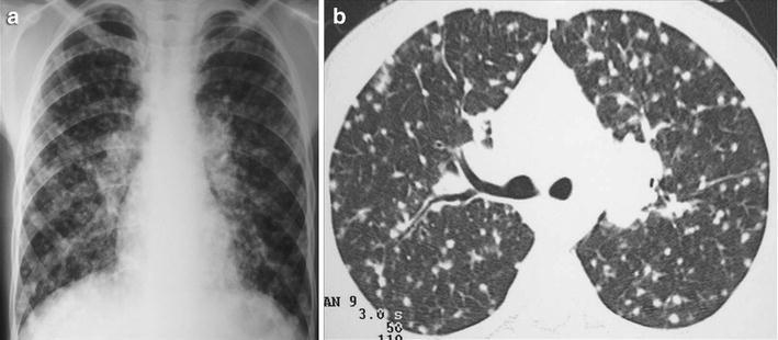 Fig. 14