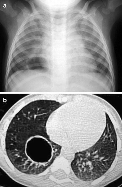 Fig. 11