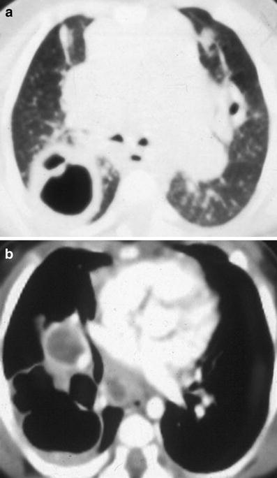 Fig. 13