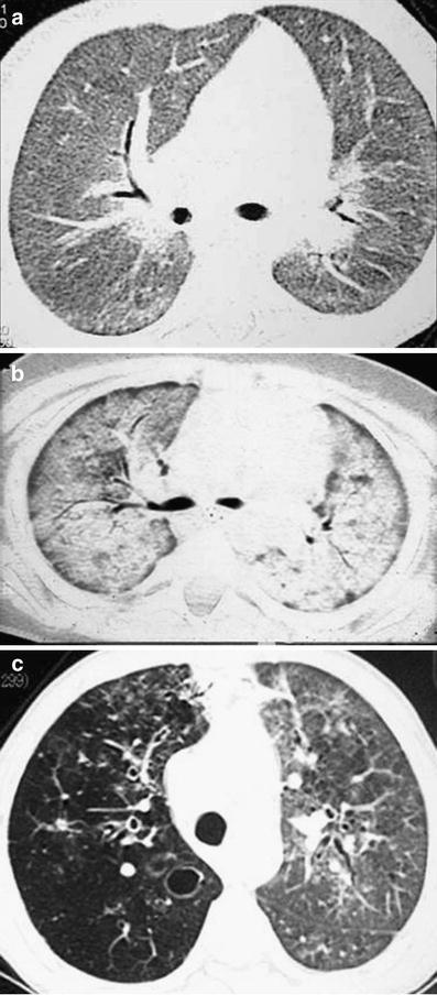 Fig. 20