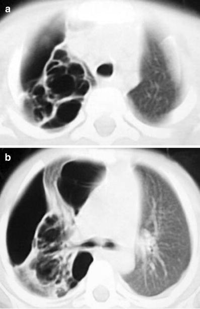 Fig. 19