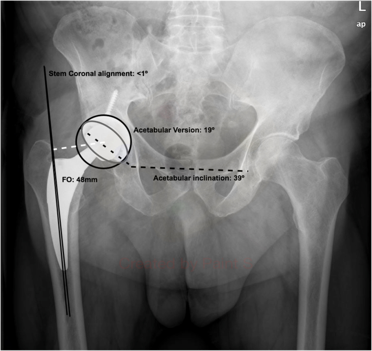 Fig. 2