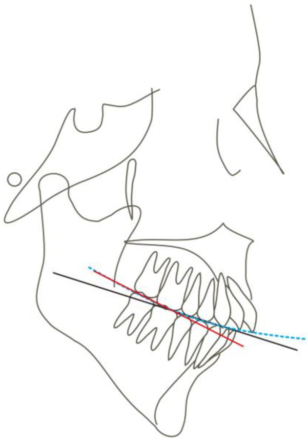 Figure 13