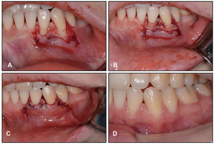 Figure 11