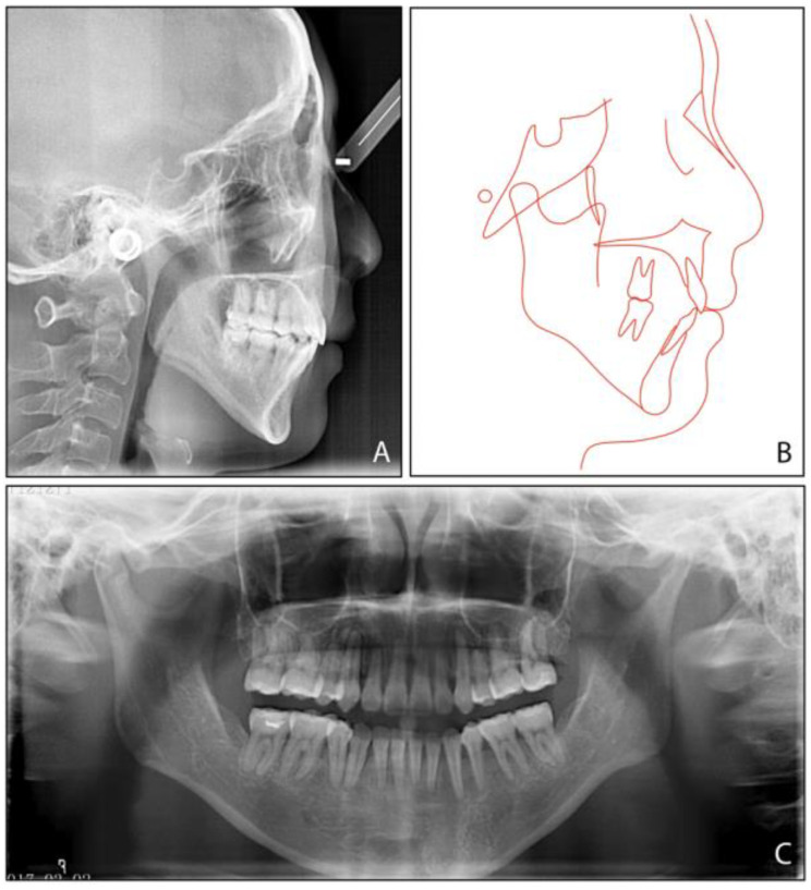 Figure 9