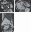 Fig. 11