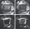 Fig. 12