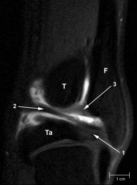 Fig. 14
