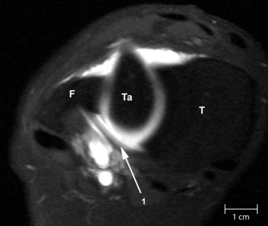 Fig. 13