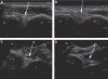 Fig. 15