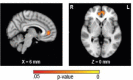 Figure 4—figure supplement 1.