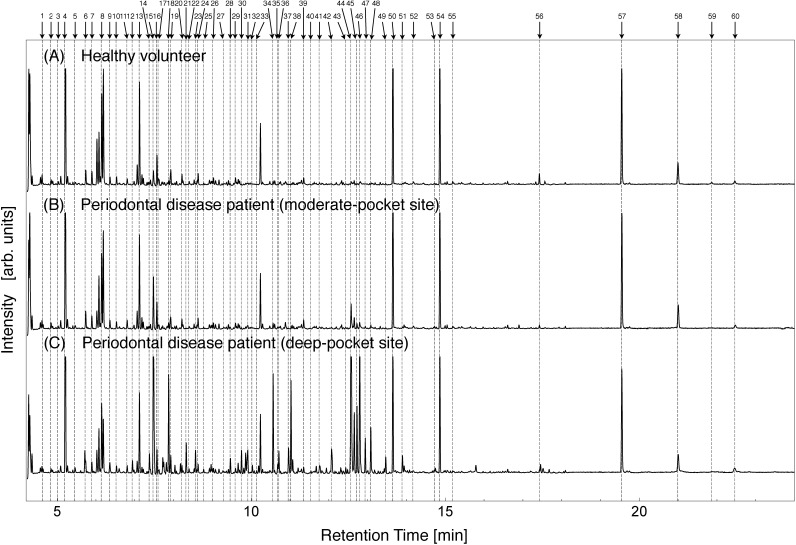 Fig. 1. TIC chromatograms of a healthy site from a volunteer (A) and the
moderate-pocket site (B) and deep-pocket site (C) from a patient with
periodontal disease.