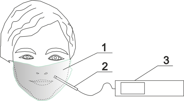 Fig. 2