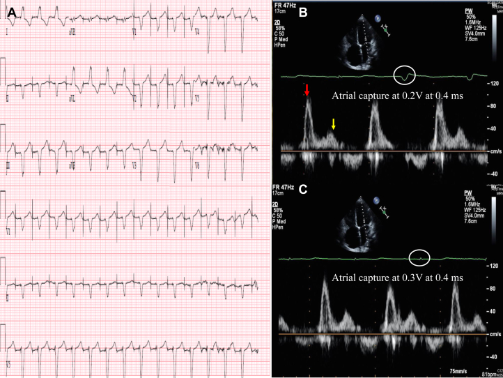 Figure 2
