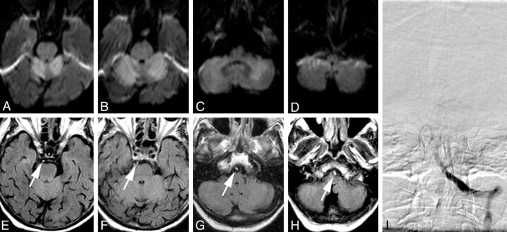 Fig 3.