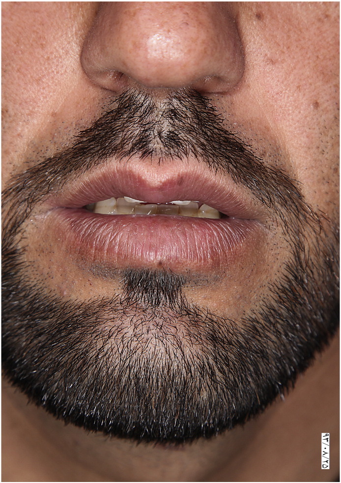Fig. 4