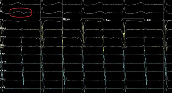 Figure 1