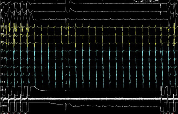 Figure 3