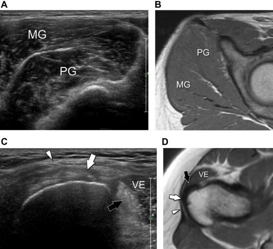 Fig. 6