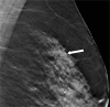 Figure 1c: