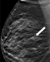 Figure 3b: