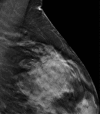 Figure 2b: