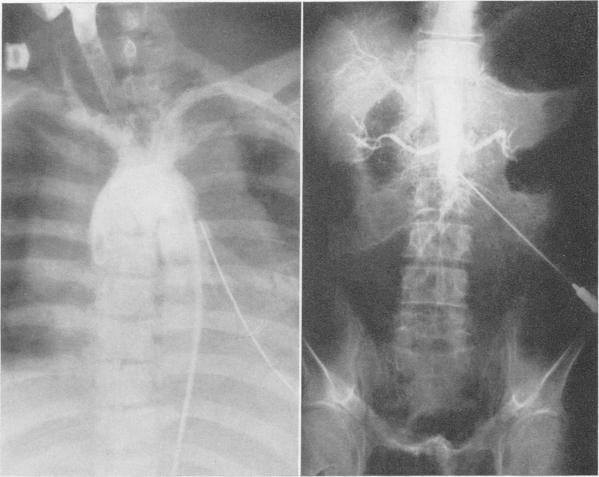 Fig. 5 (left)., Fig. 6 (right).