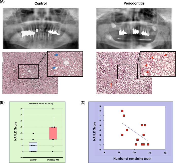 Fig. 12