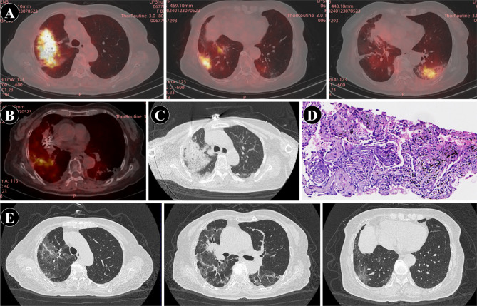 Fig. 4