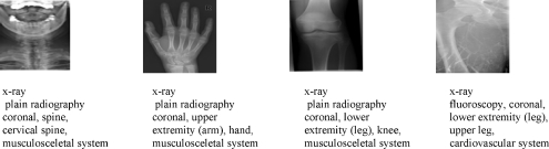 Fig. 1